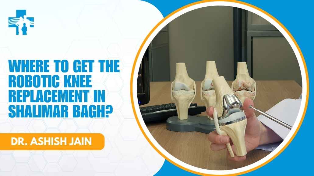 Robotic knee replacement checklist for Shalimar Bagh patients